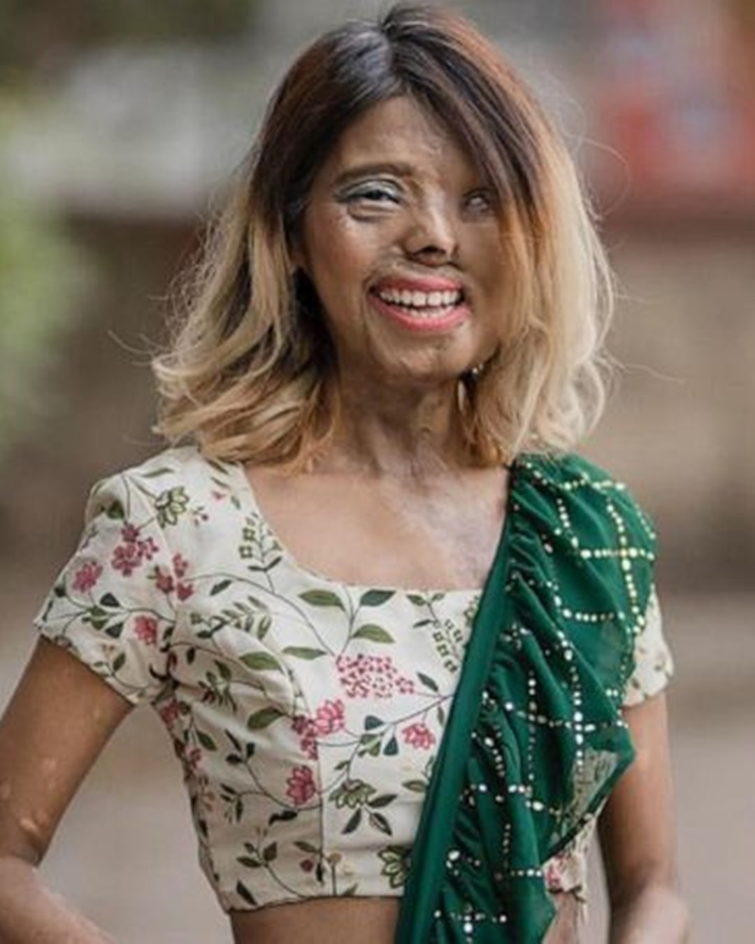 Her Soul Refused to Burn: The Inspiring True Story of Anmol, an Acid Attack Survivor Changing the World