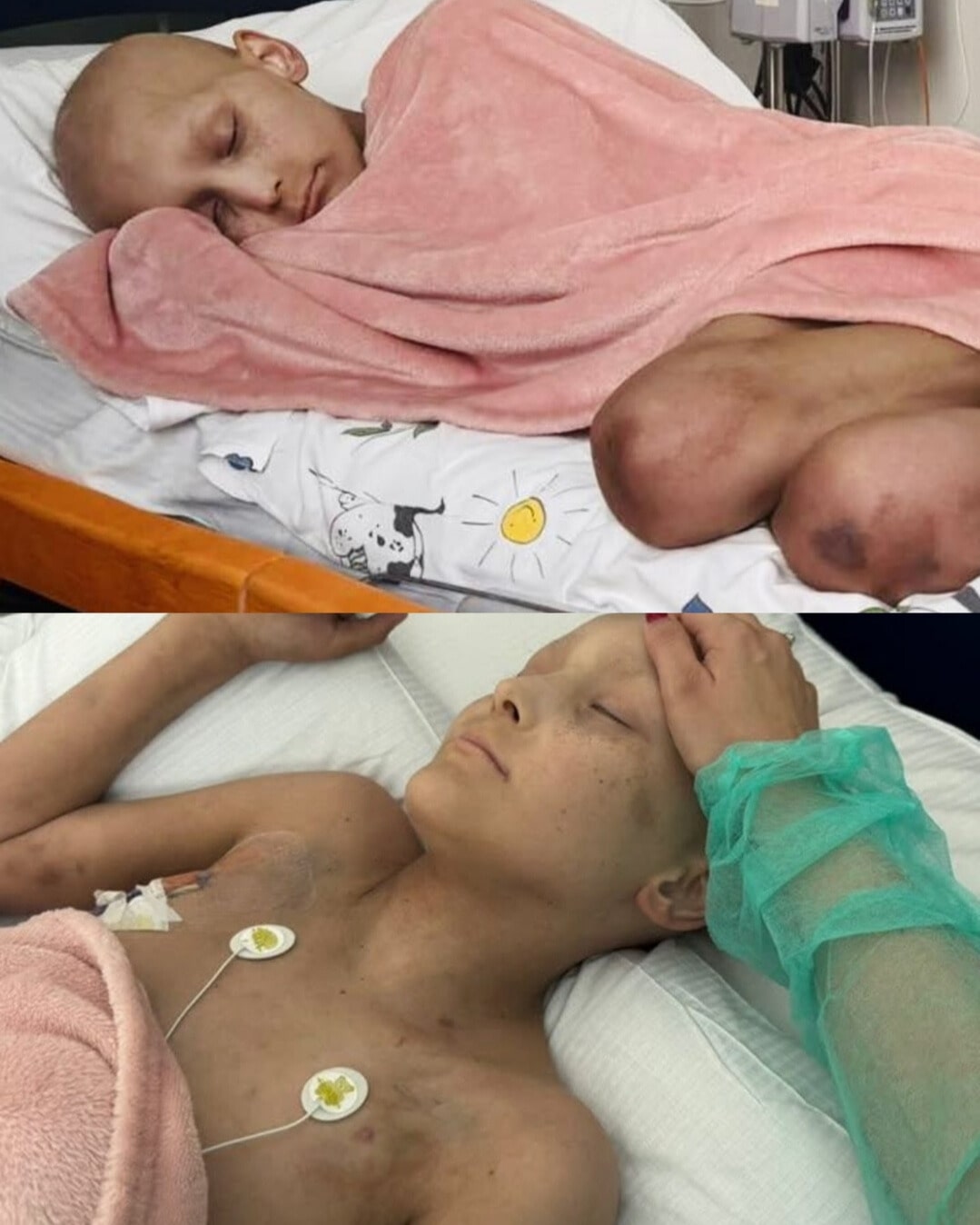 The Unbreakable Spirit of Branson Blevins: A Story of Courage, Community, and Hope in the Face of Childhood Cancer